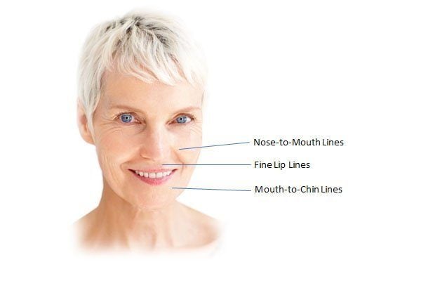 foundation dermal fillers