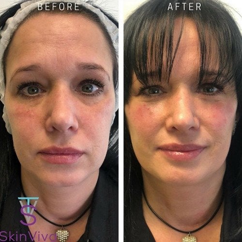 model skinviva manchester treatment